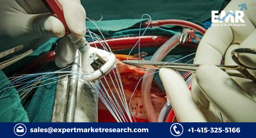 Aortic Valve Replacement Devices Market Price